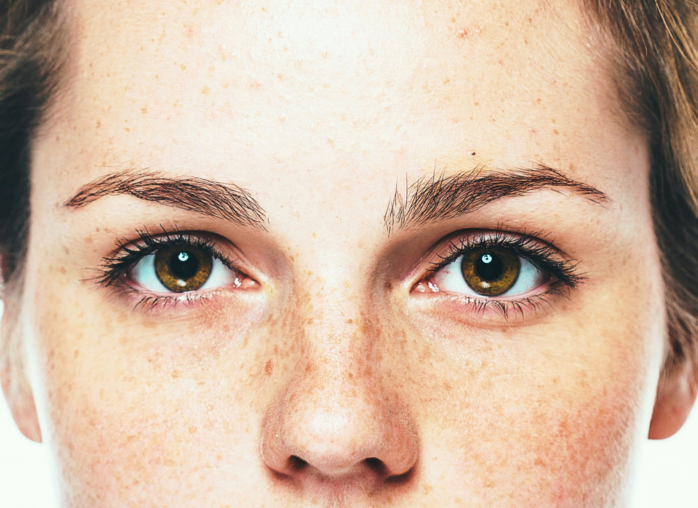 The Real Reasons Why Your Skin Is Discolored featured image