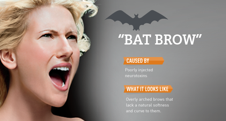 When Beauty Backfires: Bat Brow featured image