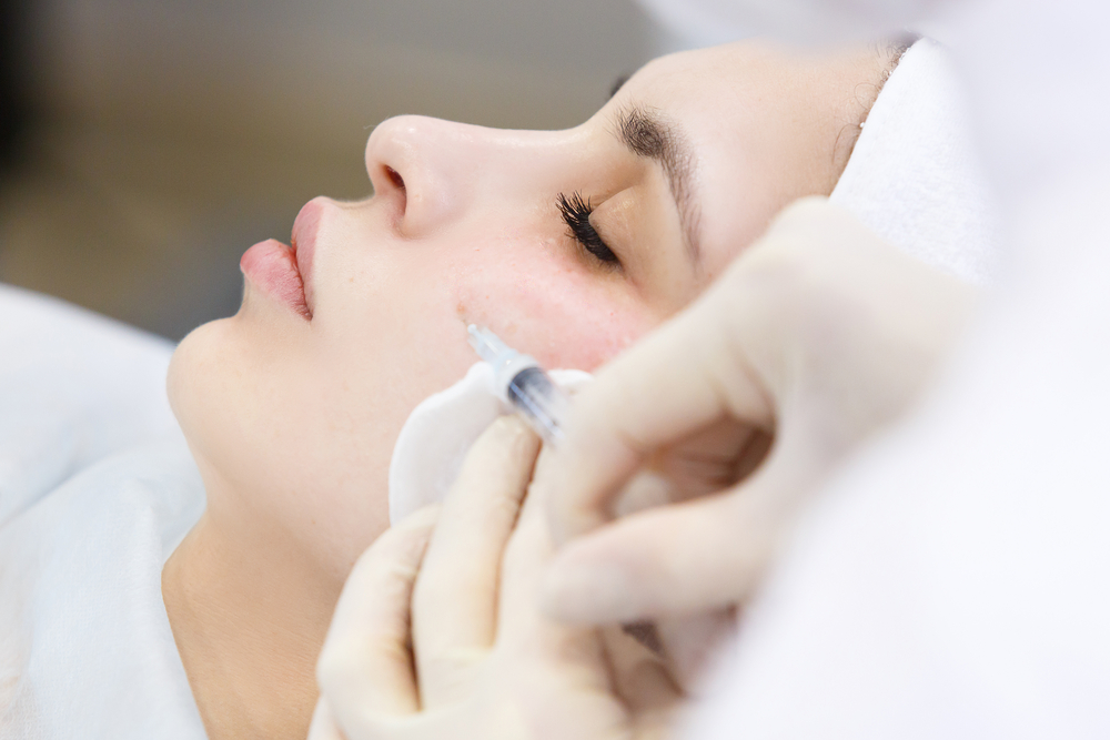 9 Key Things You Should Know About Hyaluronic Acid Fillers featured image