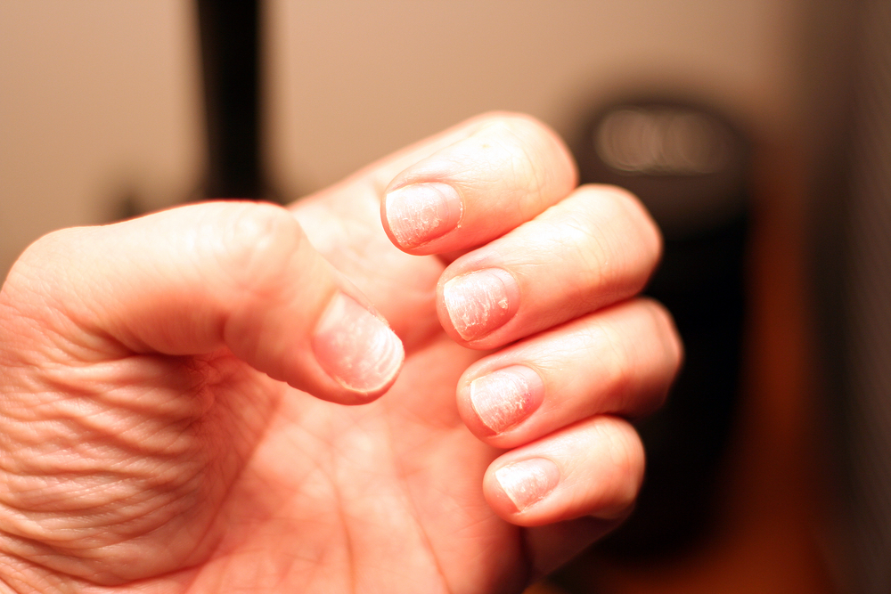 What It Really Means When You Have Ridges on Your Nails - NewBeauty