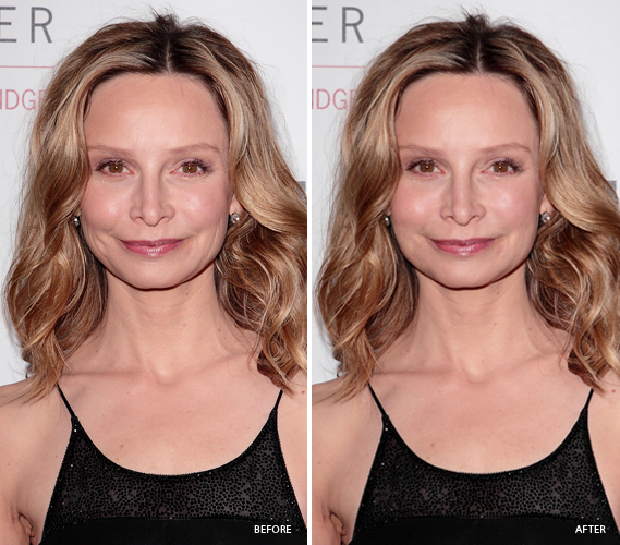 Defy Aging with Fat Calista Flockhart