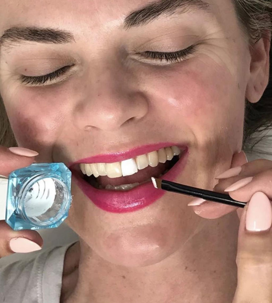 Makeup for Your Teeth Is a Thing and It’s Actually Not As Crazy As It Sounds featured image