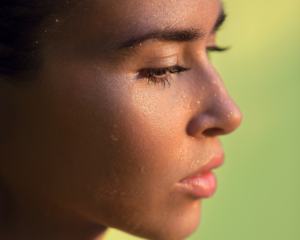 Why Your Acne Is Getting So Much Worse in the Summer featured image