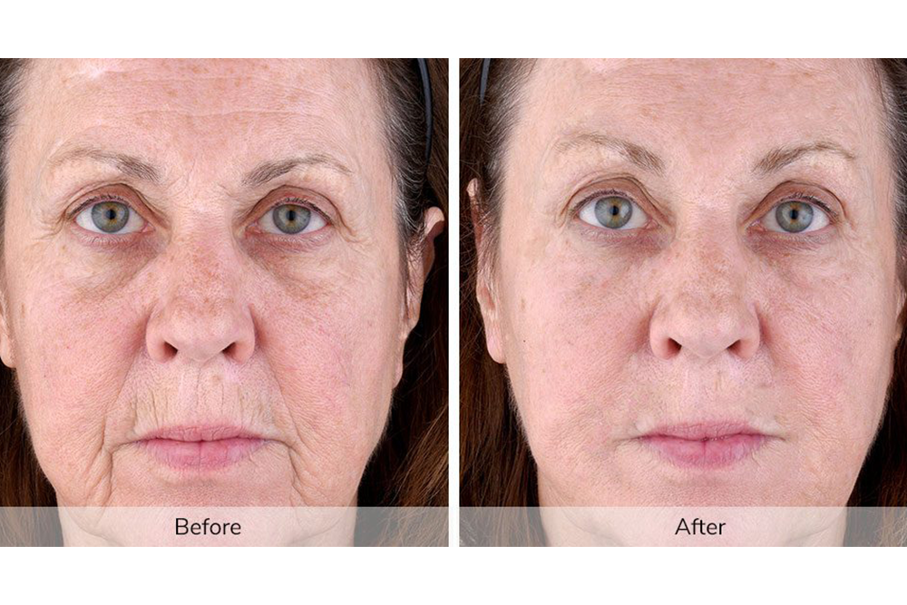 The At-Home Tool That Uses NASA Technology Research to Eliminate Wrinkles featured image