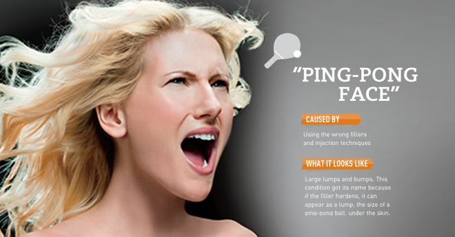 When Beauty Backfires: Ping-Pong Face featured image