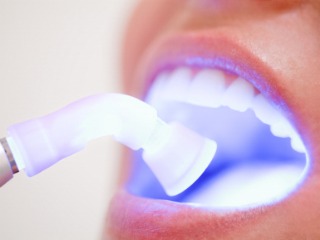 Laser Away Bad Breath featured image