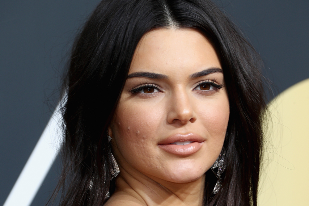 Kendall Jenner Walked the Red Carpet With Acne and Haters Had a Lot to Say featured image