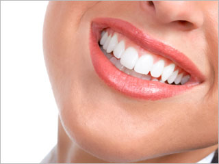 Teeth Whitening Advice From Newbeauty Readers featured image