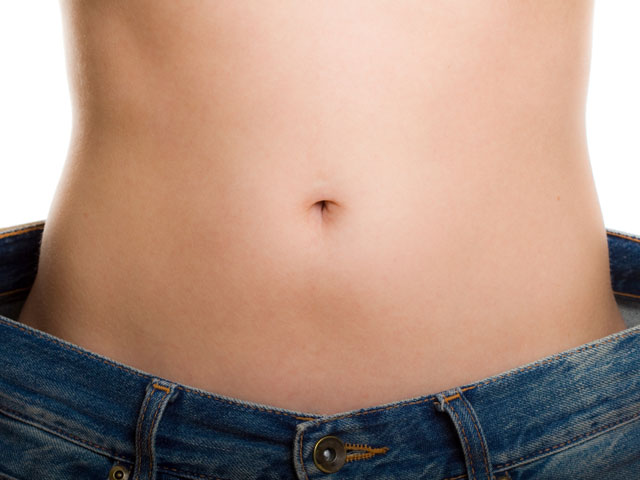 An Extended Tummy Tuck After Extensive Weight Loss featured image
