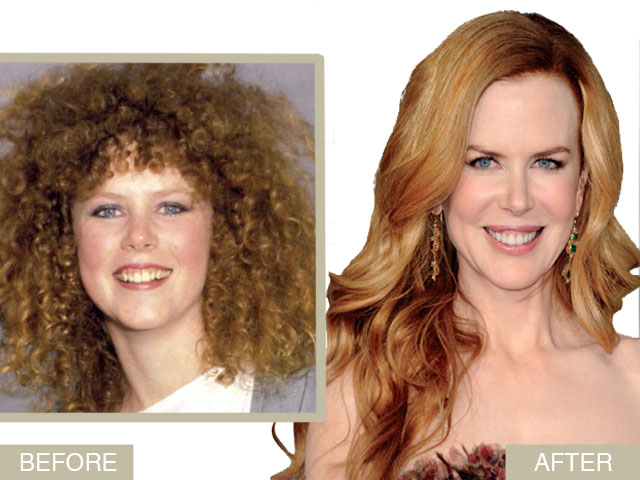Nicole Kidman’s Makeover: From Outdated To In Vogue featured image