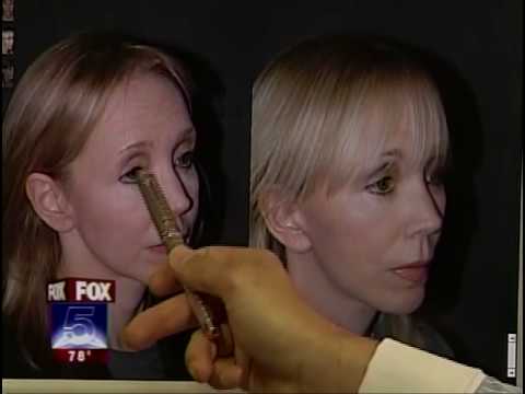 Dr. Jacono – A New York Revision Rhinoplasty Specialist featured image