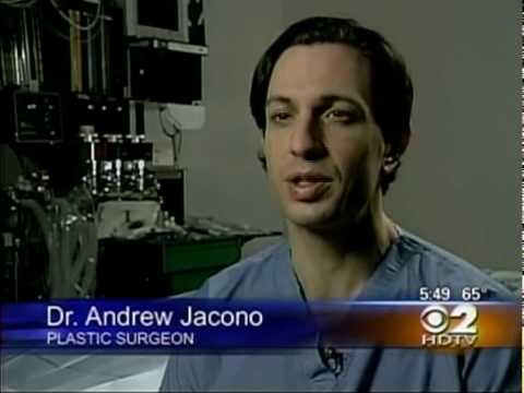 Dr. Jacono – Revision Rhinoplasty Surgery featured image
