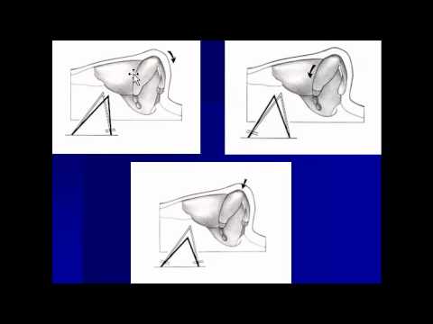 Dr. David Kim – Rhinoplasty – The Structural Approach To Rhinoplasty – Part 4 featured image