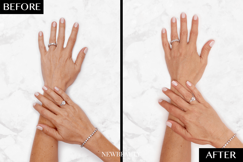 A New Way to Get More Youthful-Looking Hands featured image