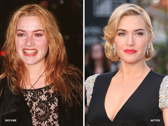 Kate Winslet’s Shabby To Chic Makeover featured image