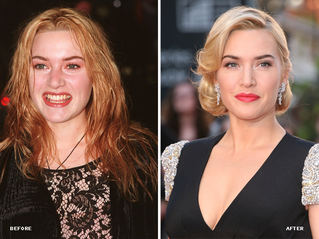 Kate Winslet