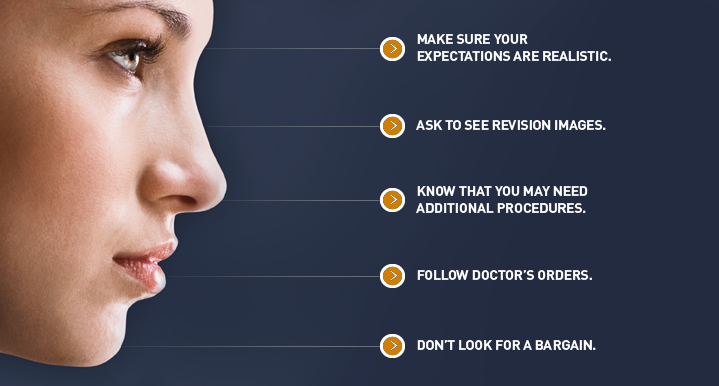 How to Avoid Bad Revision Surgery Results featured image