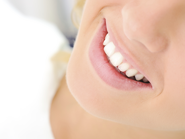 Teeth Whitening Sensitivity: Solved featured image