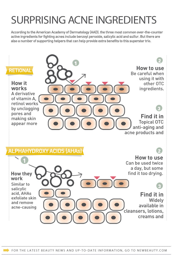 Infographic: Surprising Acne Ingredients featured image