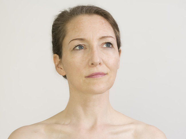 Get Rid of Hard-to-Treat Wrinkles With Lasers featured image