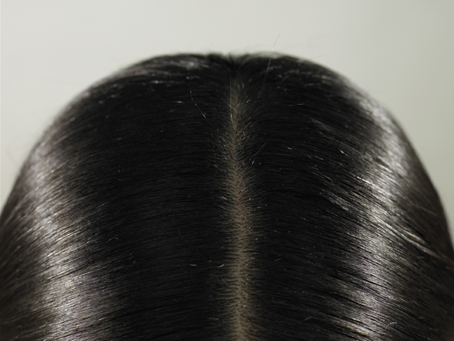 Coming Soon: A Way to Prevent Hair Loss During Chemo featured image