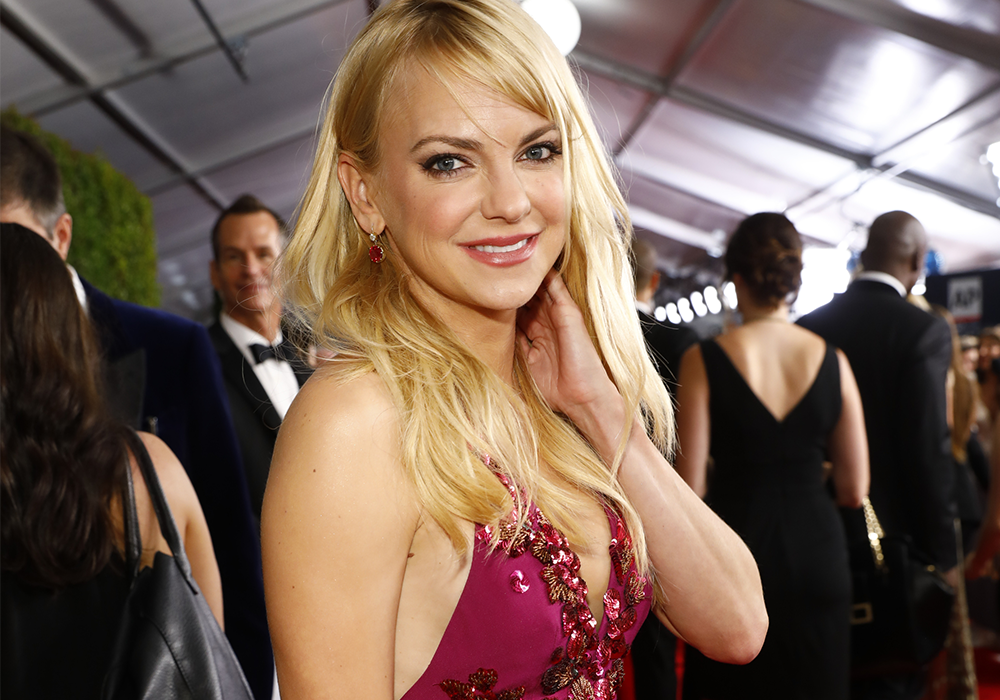 Anna Faris Reveals All the Plastic Surgery She’s Had in Her New Book featured image