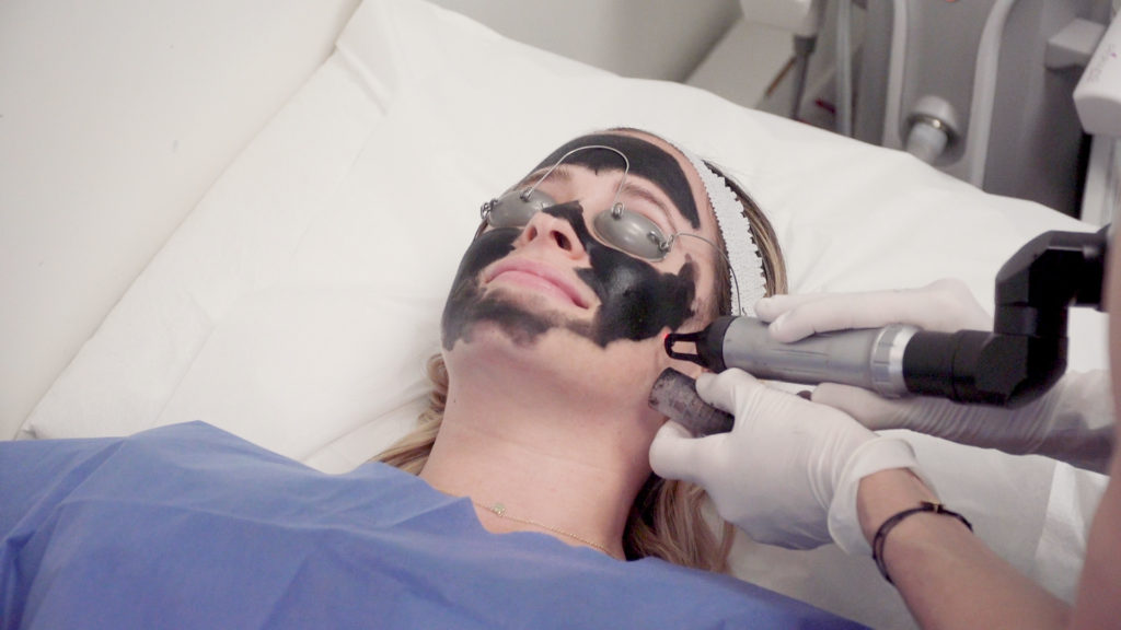 The Carbon Laser Peel Is the Secret to Better Skin in 20 Minutes featured image