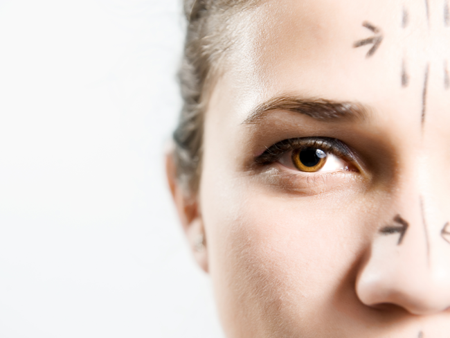 What to Know Before Getting a Facelift featured image