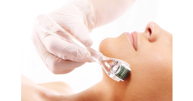 The Truth About Microneedling featured image