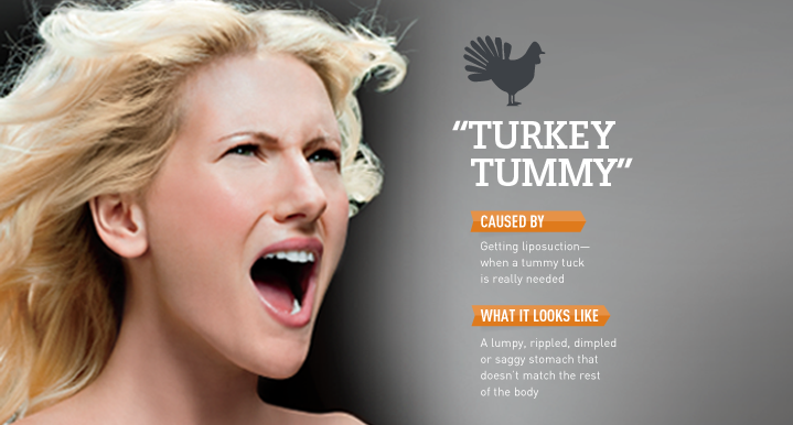 When Beauty Backfires: Turkey Tummy featured image
