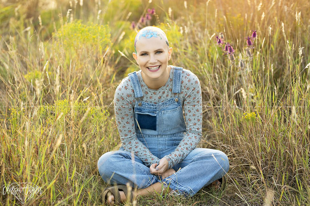 These Senior Photos of a Teen With Alopecia Are Going Viral  featured image