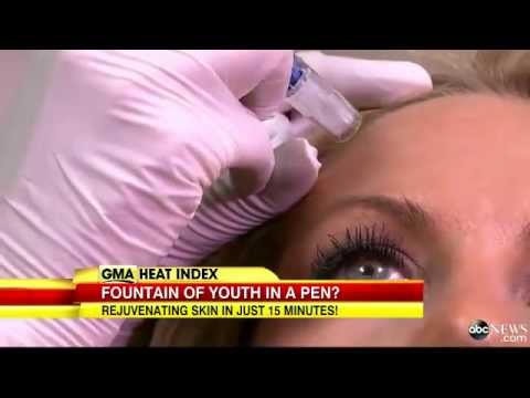 GMA: Micro Needling Can Improve Acne Scars and Rejuvenate your Skin featured image