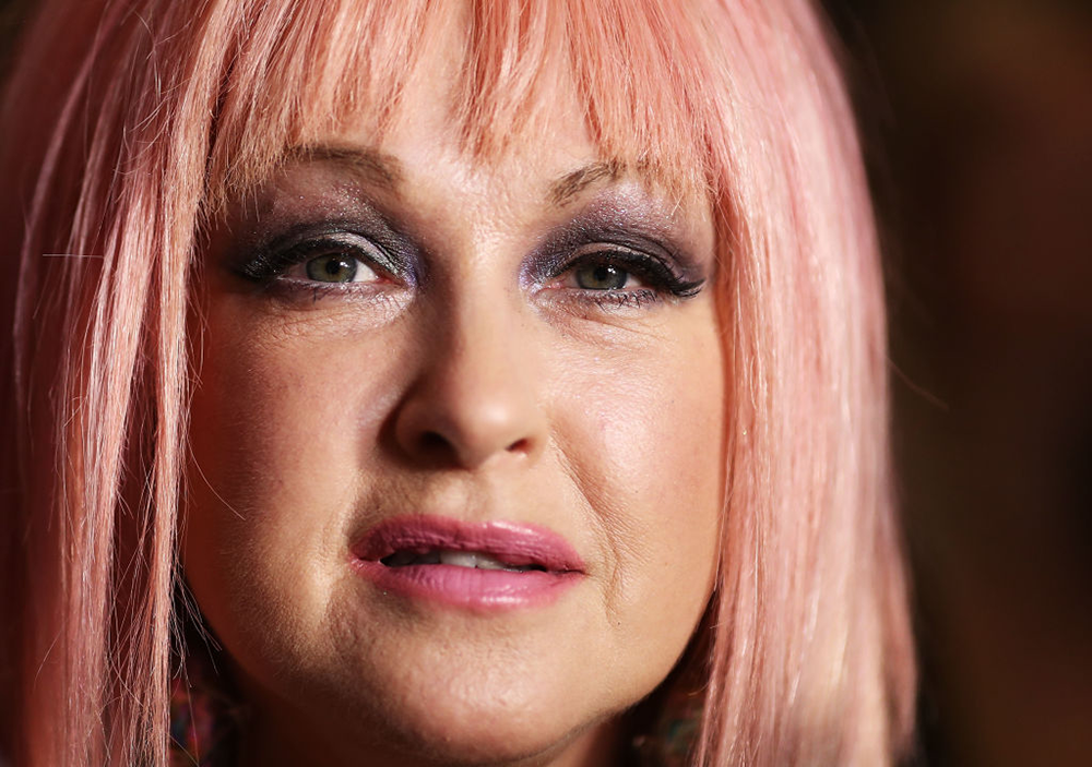 Cyndi Lauper Speaks Out About Her Ongoing Battle With This Skin Condition featured image