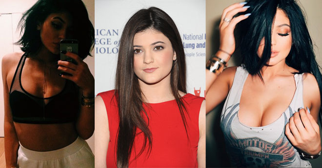 Rumor Has It: Did Kylie Jenner Get Breast Implants? featured image