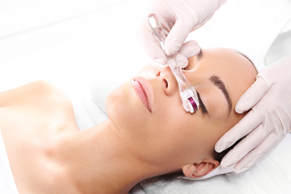 How Microneedling is Getting Even More Effective featured image