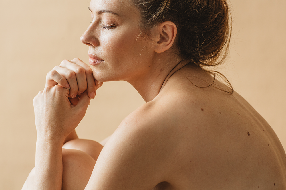 Topical Sculptra is the Off-Label Scar Treatment Everyone Needs to Know About featured image