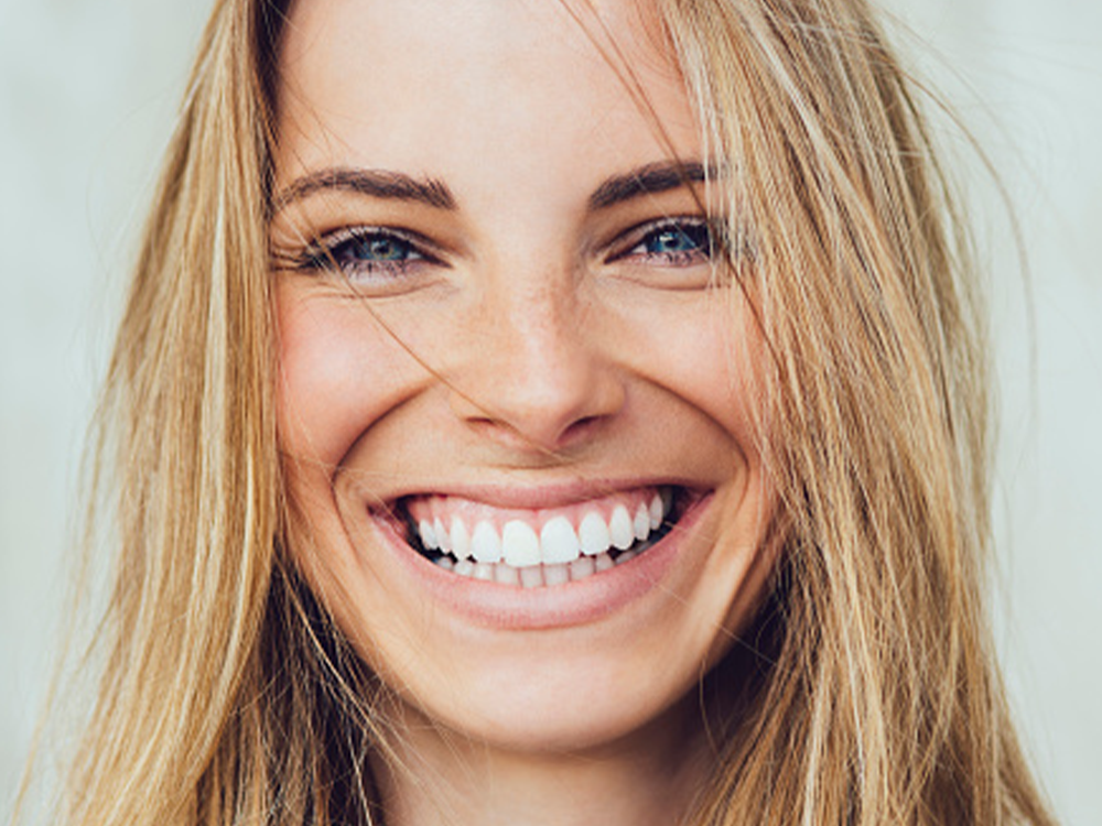 An A-to-Z Guide to Teeth Whitening, According to Cosmetic Dentists featured image