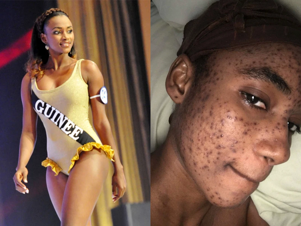 Model Claims This Skin-Care Line Caused Lifetime Worth of Damage on Her Once Flawless Complexion featured image