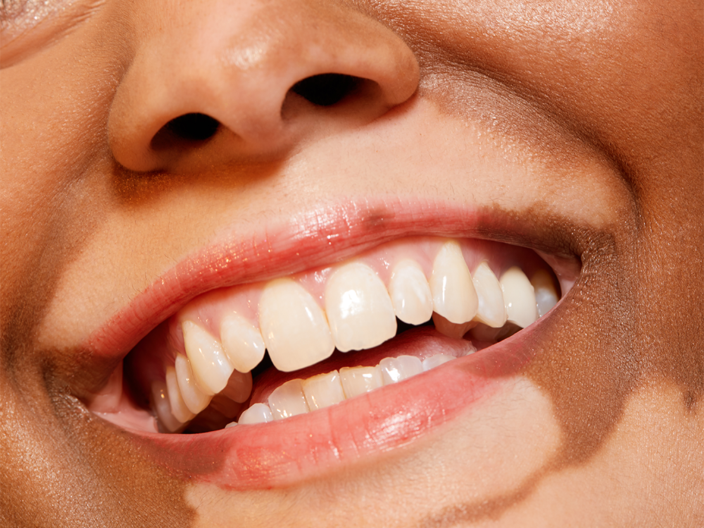Easy Ways to Keep Your Mouth Clean, According to Seven Cosmetic Dentists featured image