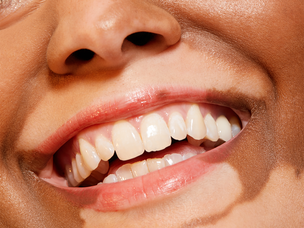 Maximizing Oral Health: Easy Ways to Keep Your Mouth Clean, According to Dentists featured image