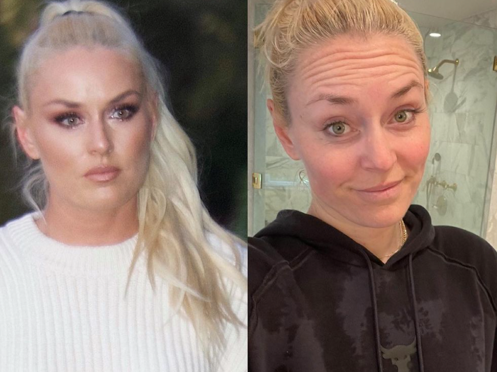 Lindsey Vonn’s No-Makeup Selfie Shows That Beauty Comes From Within featured image