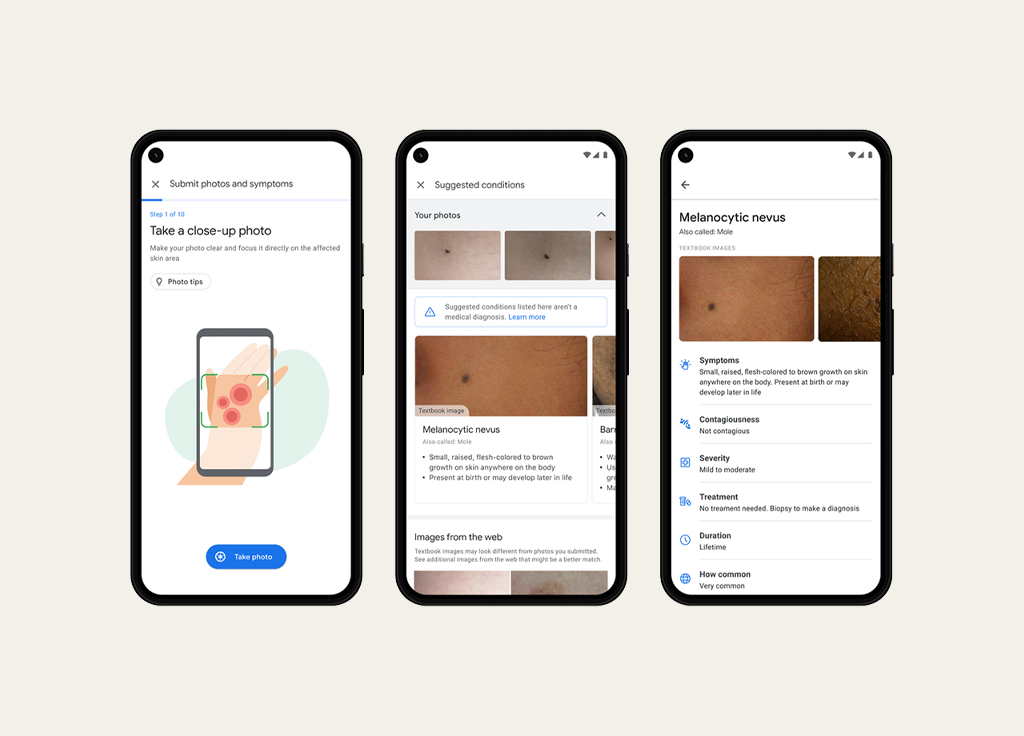Google’s New AI-Powered Tool Might Help Assess Skin Conditions featured image