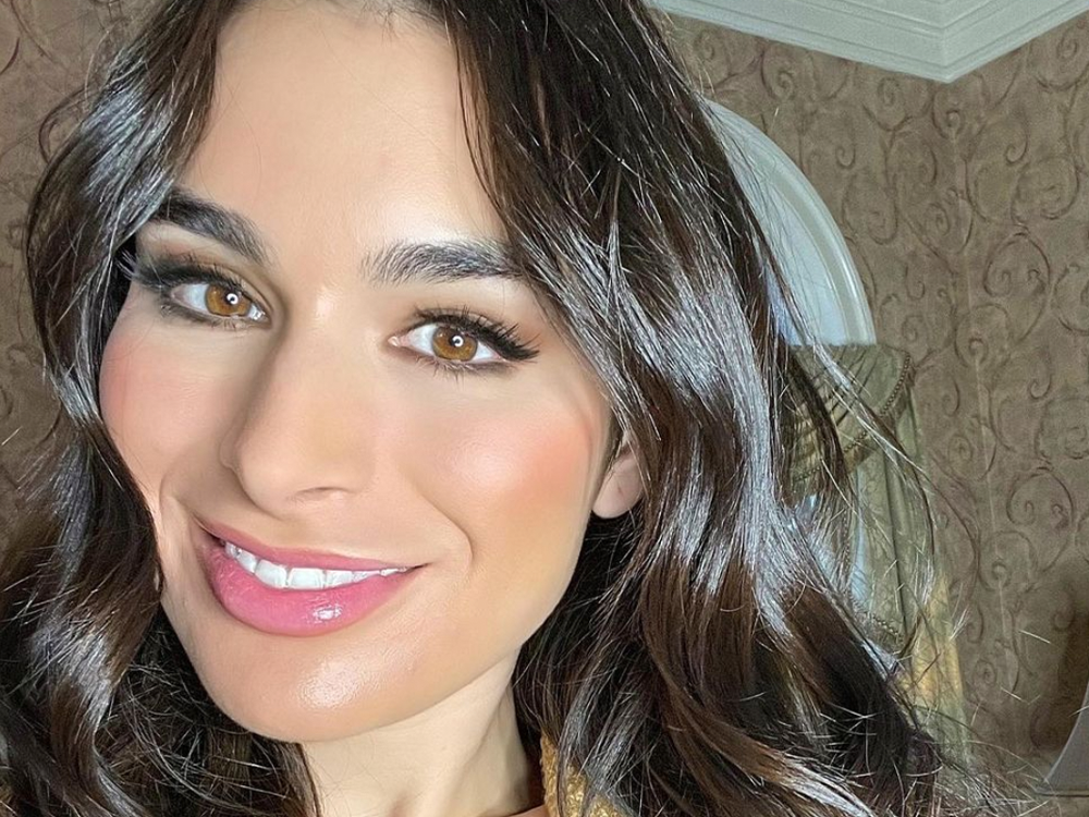 Ashley Iaconetti Gets Real About Her Pregnancy-Induced Acne featured image