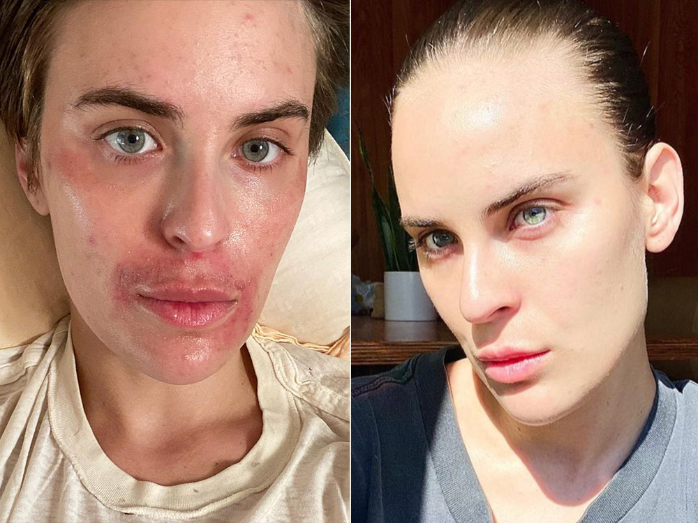 Tallulah Willis Shares the Details of Her Skin-Care Routine featured image