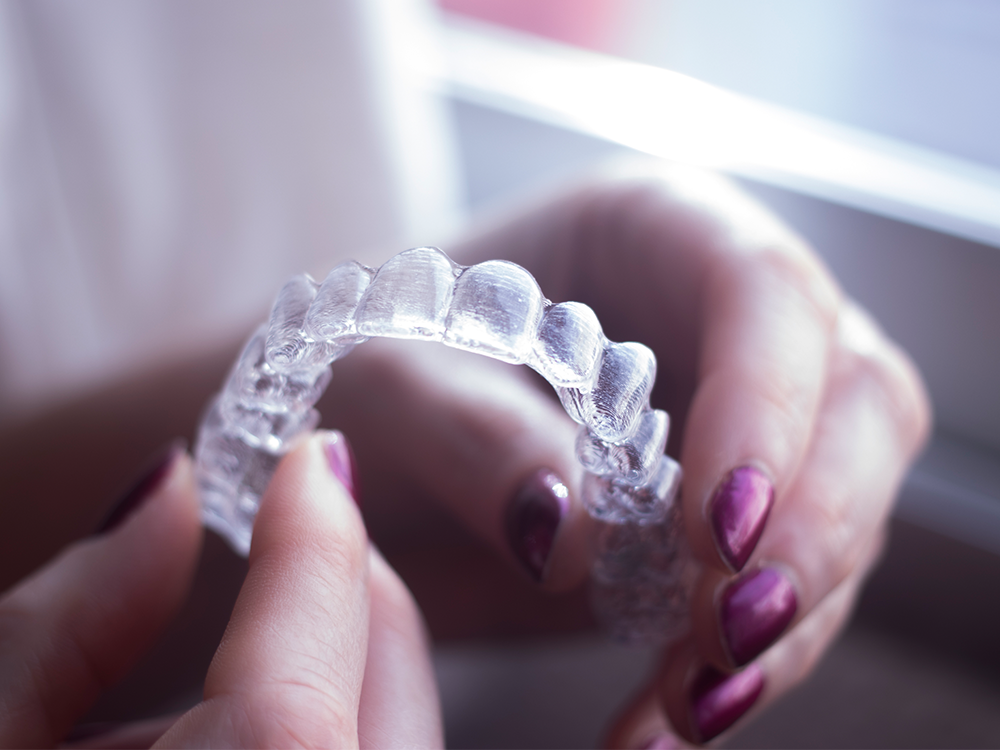 Why This Top Dentist Sometimes Recommends Invisalign Instead of Porcelain Veneers featured image