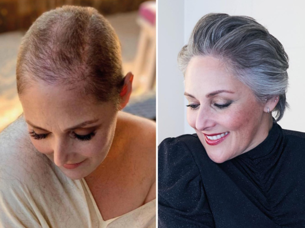 Ricki Lake Shares Her Impressive Transformation After Years of Struggling With Hair Loss