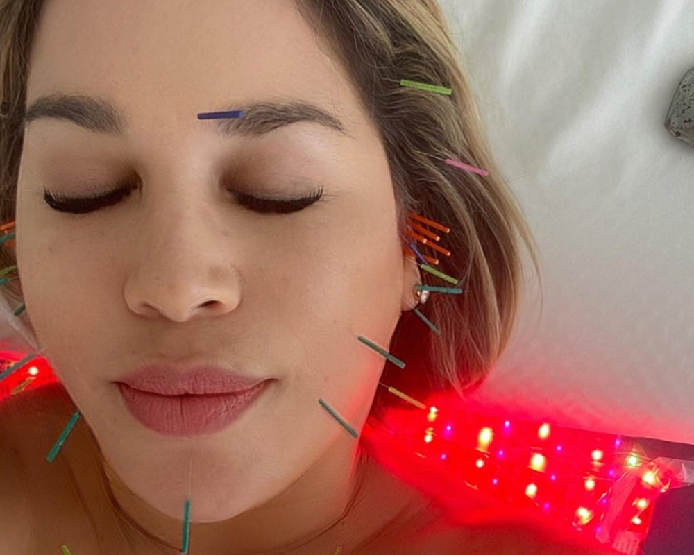 How This Acupuncture Treatment Can Help Recontour Your Face featured image