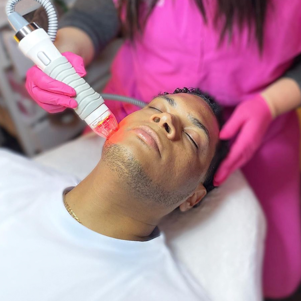 VivaceUltra - The Differences Between the Most Popular Radio-Frequency Microneedling Treatments
