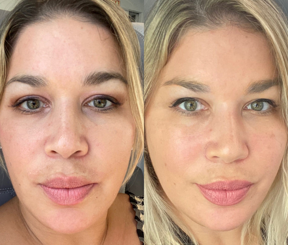 What Has Worked Best for My Skin at 45