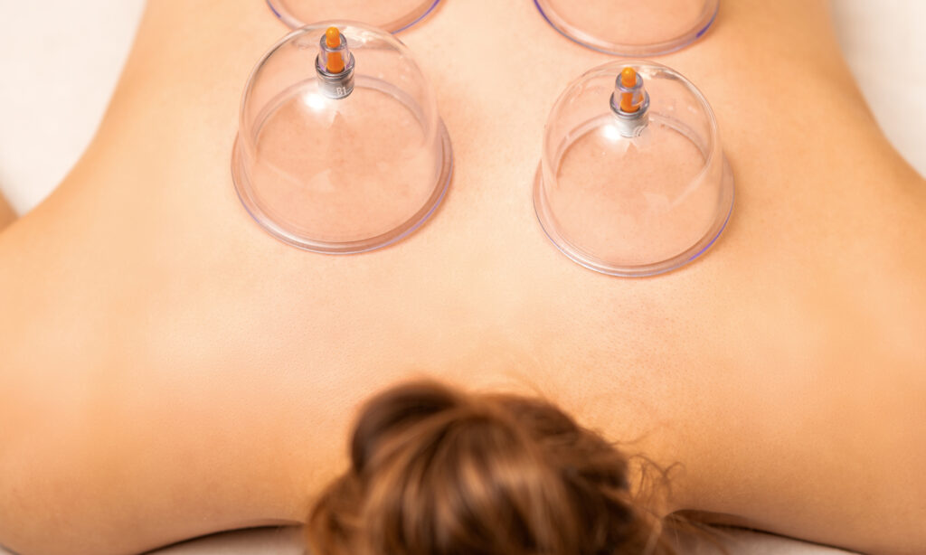 13 Surprising Benefits of Face and Body Cupping featured image